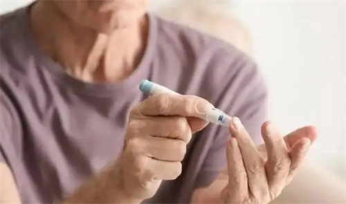 图片细节